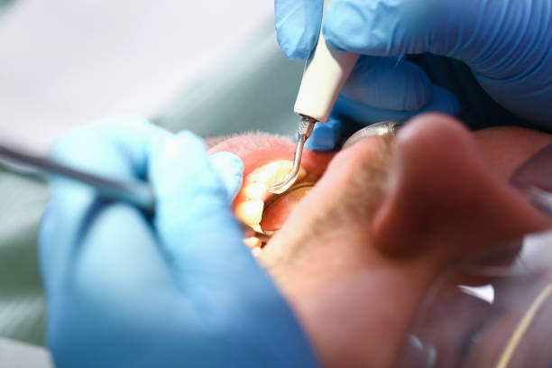 Best Emergency Treatment for Toothache in Rice Lake, WI